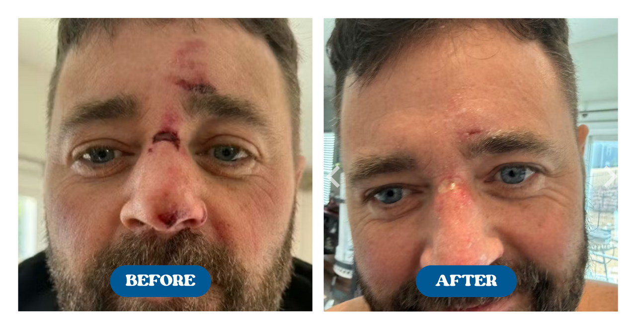 Before and after comparison of a man's face with visible improvement.